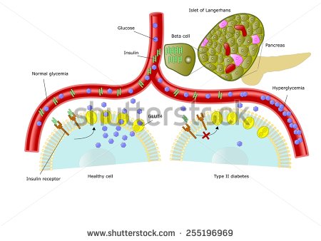 type-ii-diabetes-with-impaired-control-of-glycemia-255196969