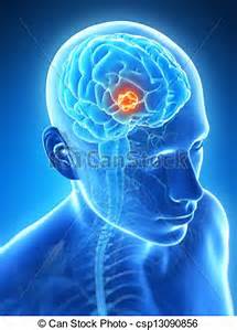 braintumor